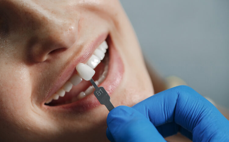 dentist-whiting-teeth